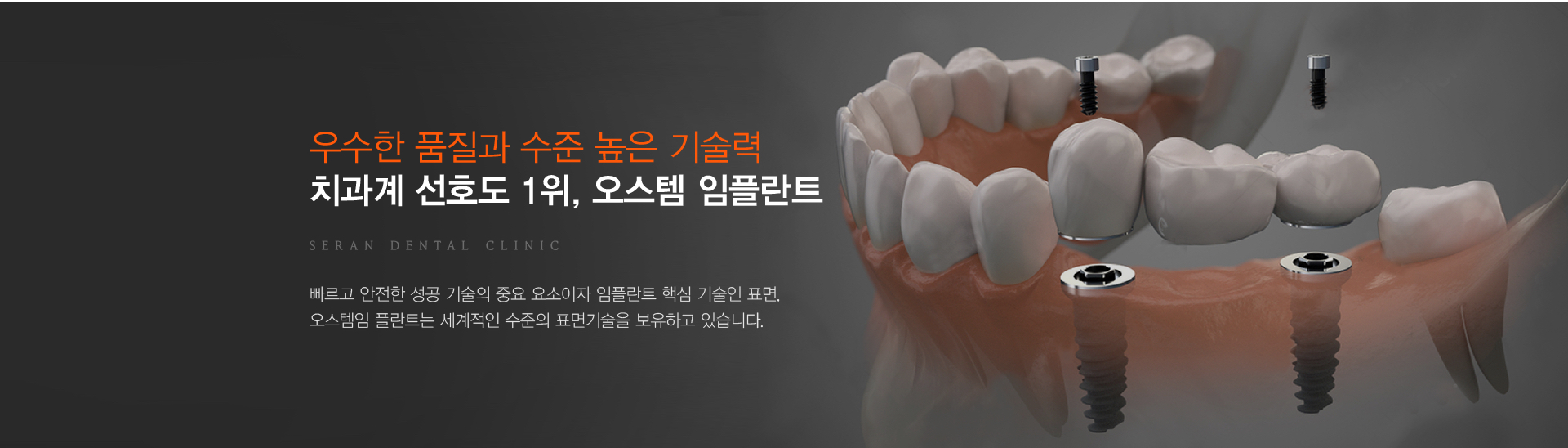 빠르고 안전한 성공 기술의 중요 요소이자 임플란트 핵심 기술인 표면,
                  오스템임 플란트는 세계적인 수준의 표면기술을 보유하고 있습니다.